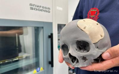 В Уфе научились создавать 3D-импланты костей черепа В Уфе научились создавать 3D-импланты костей черепа